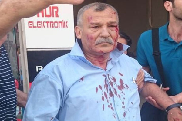 İki bombalı saldırıdan da sağ kurtuldu