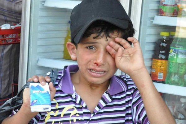 Suriyeli çocuğa saldıranlar için yasal süreç başlatıldı