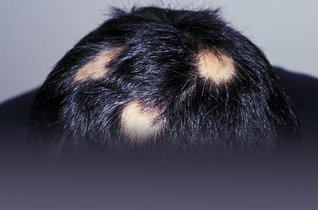 Saçkırana sakın bunu yapmayın