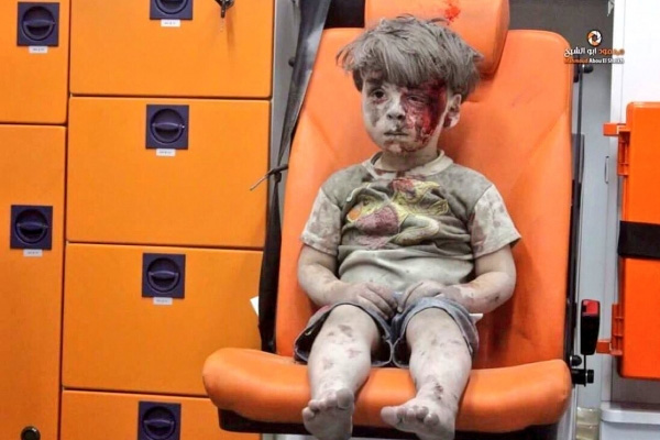 Ümran bebek Rus saldırısında ağır yaralandı