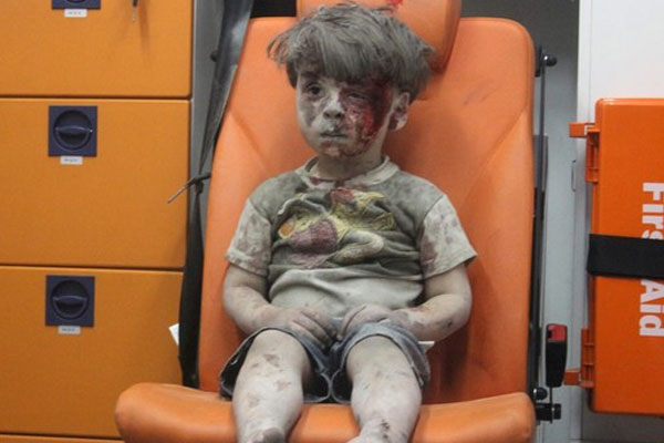 Ümran bebeğin ağır yaralı olduğu iddia edildi