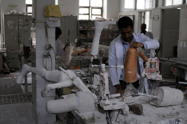 Türkiye'den Yemen'e protez desteği