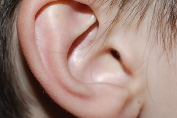 Çocuğun kulağından 14 sinek larvası çıktı