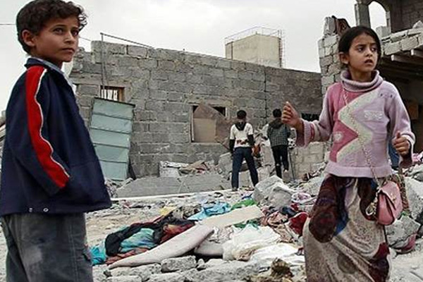 Yemenli çocuklar açlıktan hayatını kaybediyor