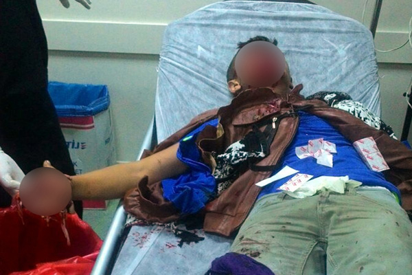 Polise atmak istediği bomba elinde patladı