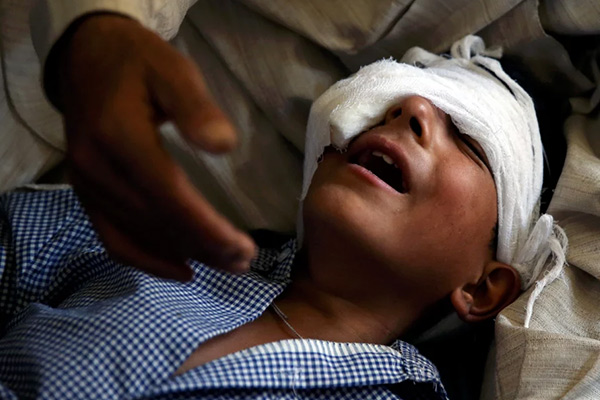 Hindistan'ın hedefindeki Keşmirli çocuklar