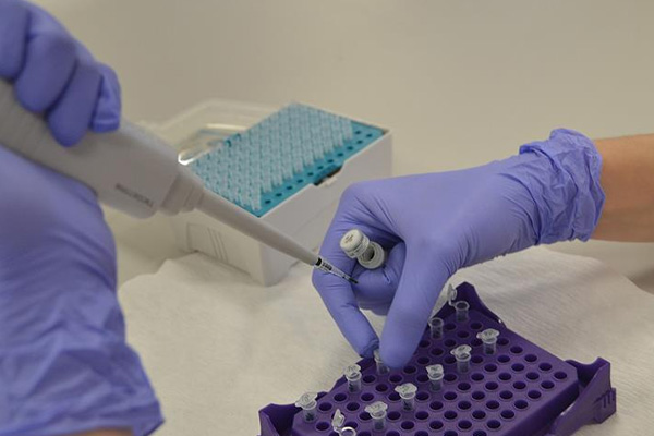 Akciğer kanserine yerli 'tanı kiti'