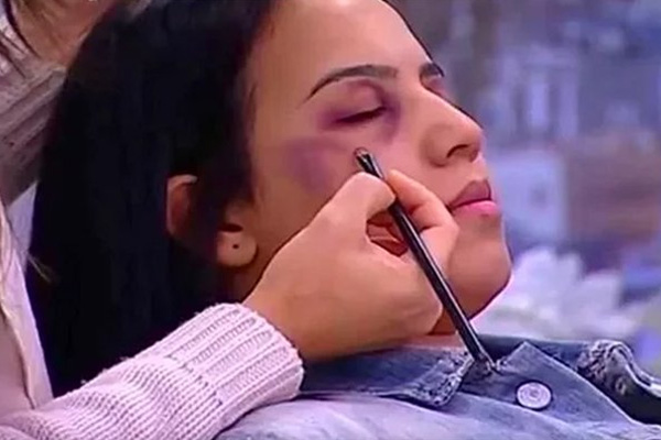 Kadına şiddetin izlerini makyajla kapatmayı öğreten kanaldan açıklama