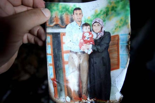 Filistin'de yakılan bebeğin babası da öldü