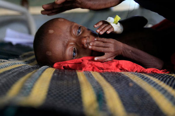 Gıda kıtlığı uyarısı