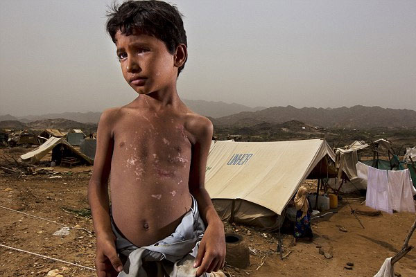 UNICEF'den Yemen çocuk raporu