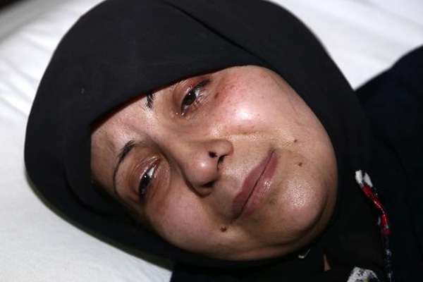 Halepli Ciyazera: İnsanlar kan ağlıyor