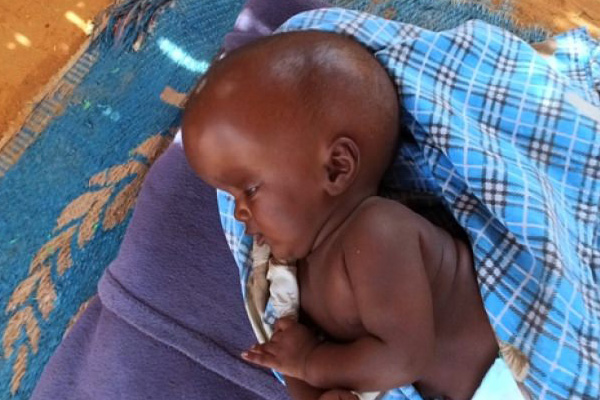 Türk doktorlar Somali'de