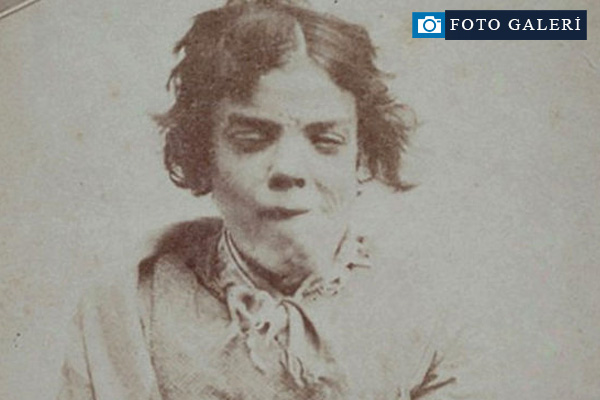 1800'lerin akıl hastanesinden tüyler ürperten fotoğraflar