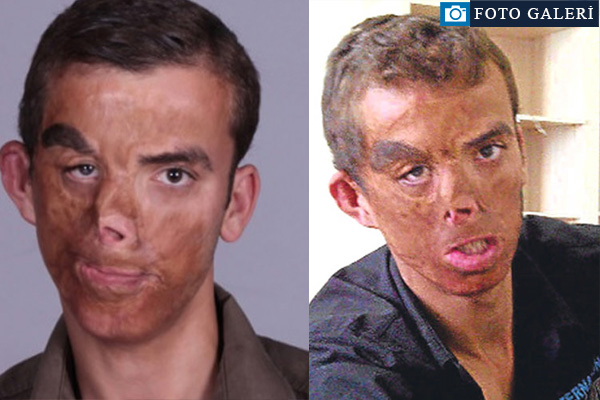 Yeni yüzü ve son haliyle Uğur Acar