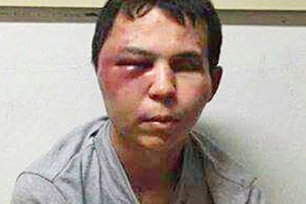 Reina katliamcısı sağlık kontrolünden geçirildi