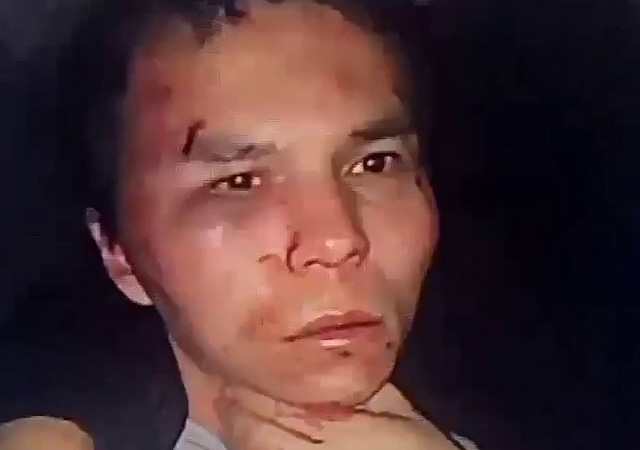 'Canlı bomba malzemelerine ulaşamayınca silahla saldırdı'