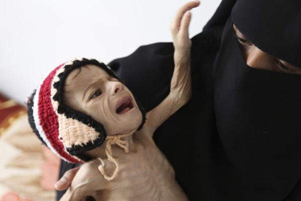 BM'den Yemen için kıtlık uyarısı!