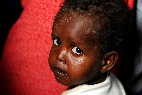 Somali'de kıtlık tehlikesi