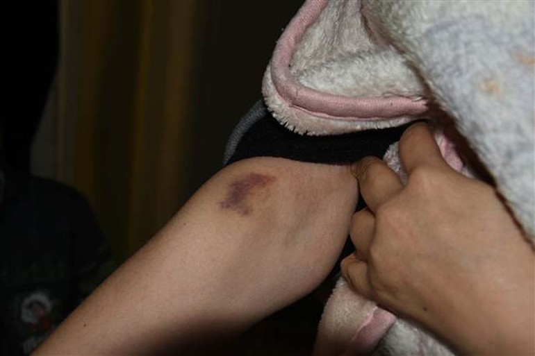 Suriyeli bebek ve anneyi fareler kemirdi