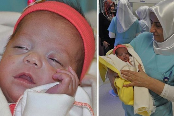 560 gramlık bebek hayata tutundu