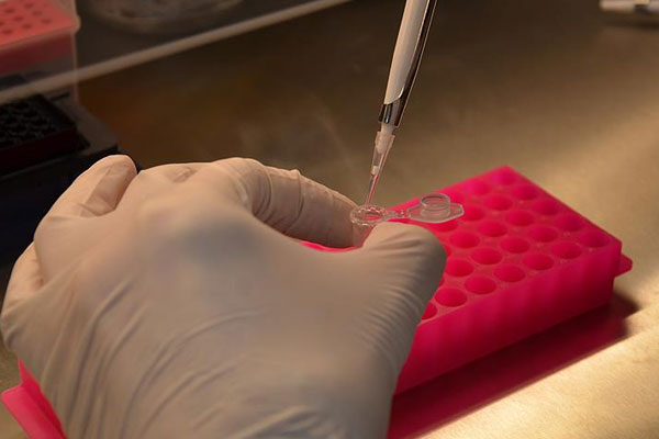 New York'ta fareden bulaşan hastalık korkuttu