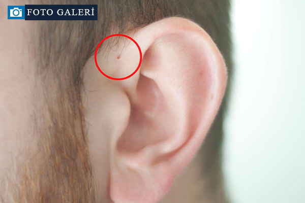 İnsan kulağının üzerinde yer alan delik nedir?