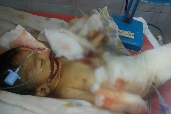 10 günlük bebeği fareler öldürdü