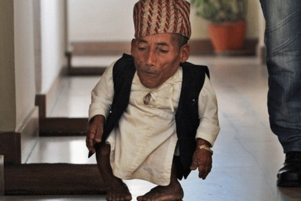 Dünyanın en kısa adamı hayata veda etti