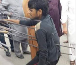 Kızgın demirleri vücuduna sapladı!