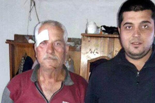 Aydın'da vaşak çiftçiye saldırdı