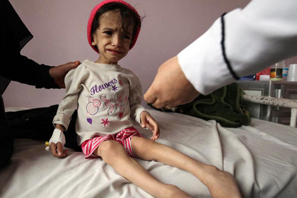 İHH’dan Doğu Afrika ve Yemen için acil yardım çağrısı