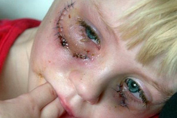 Küçük kıza köpek saldırdı, İslamofobia hortladı!