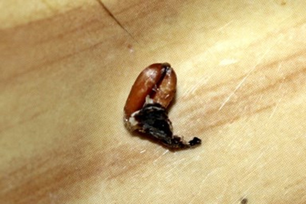 Kulağından filizlenmiş buğday çıktı