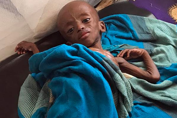 İHH’dan Somali krizi raporu: İnsanlık Kurumasın