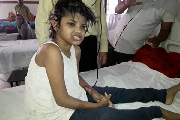 Yıllarca maymunlarla yaşayan bir kız çocuğu bulundu!