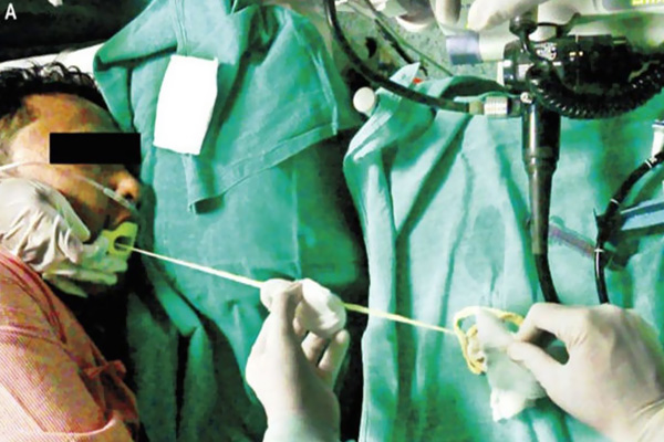 Midesinden tam 183 santimlik kurt çıkardılar!