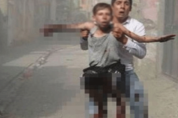 Cizre'de elini kaybeden Yusuf: Ben nasıl kalem tutacağım?