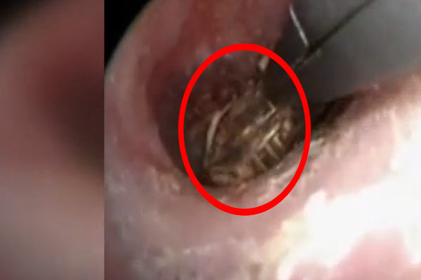 Kulağından örümcek çıktı!