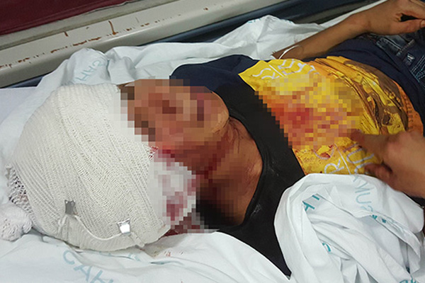 Tüfekle oynarken arkadaşını kafasından vurdu