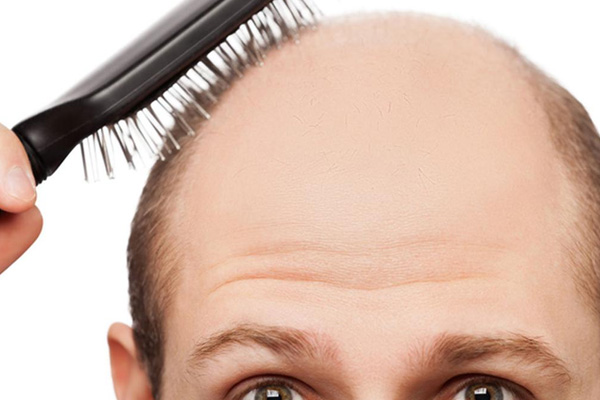 Kelliğin nedeni bulundu