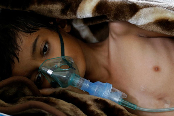 Yemen'deki kolera salgını ülke dışına yayılabilir!