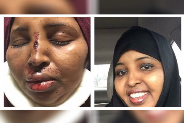 ABD'de Müslüman kadına ırkçı saldırdı