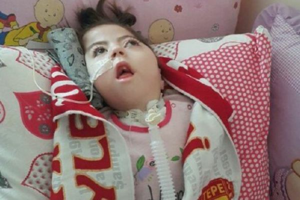 Doktorların 'yaşamaz' dediği Esila Avcı 2,5 yaşında