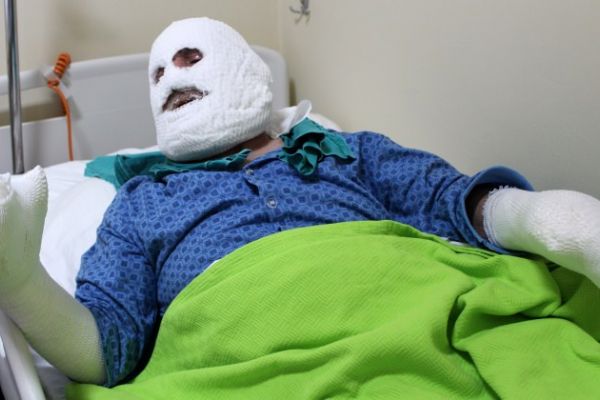 Herşey biranda oldu! Sahurda yemek ısıtmak isterken...!