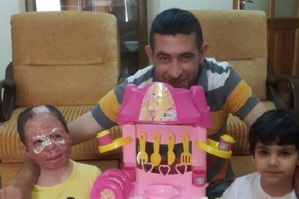 Rejimin saldırısında yaralanan Minik Hibe yardım bekliyor