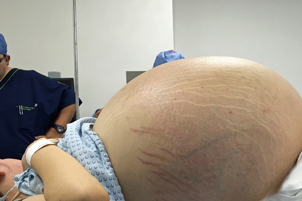 Hamile olduğunu sandı, büyük şok yaşadı