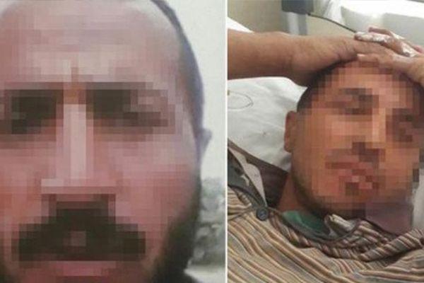 Denizli'de domuz sanılıp vurulmuştu! Gerçek çok farklı çıktı