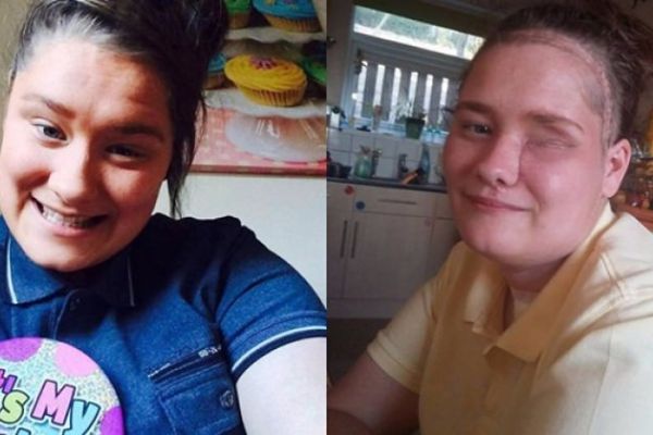 Apse tedavisine gitti, gözünden oldu