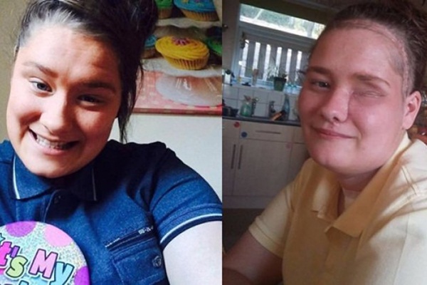 Apse tedavisine gitti, gözünü kaybetti